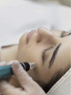 Dermapen facial treatment with a pen applicator against the cheek