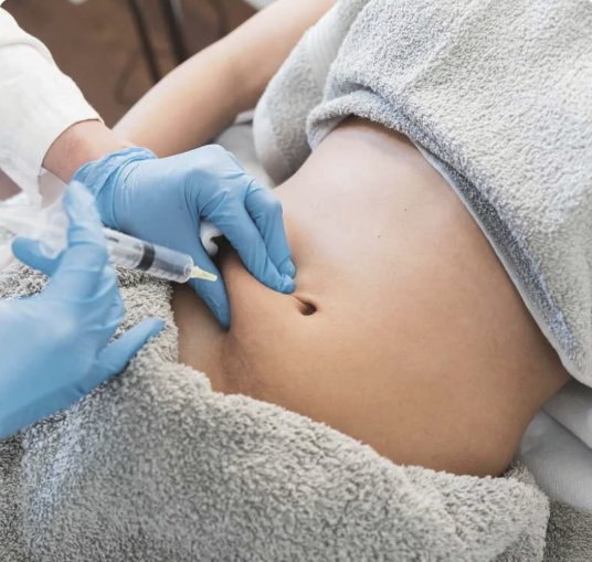 Abdominal fat dissolving treatment with a syringe and gloved hands