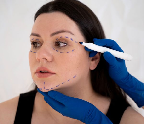 Everything You Need to Know About Dermal Fillers