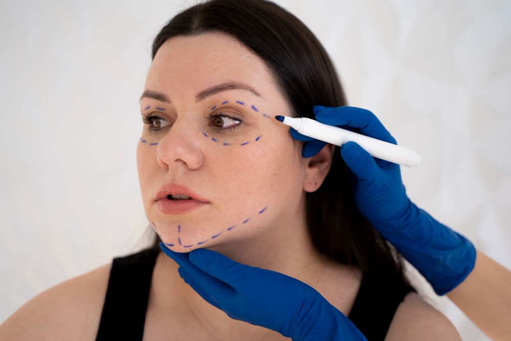 Everything You Need to Know About Dermal Fillers